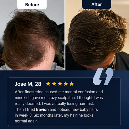 Iravion™ Hair Growth Roll-On